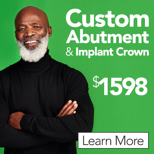 $1598 Custom Abutment & Implant Crown
