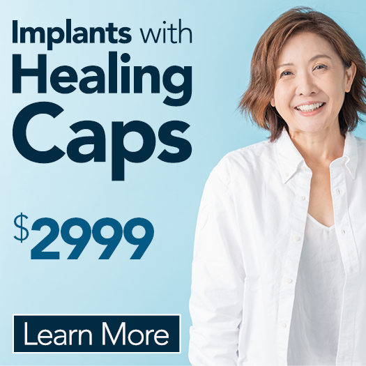 $2999 (2) Implants with Healing Caps
