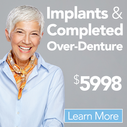 $5998 (2) Implants & Completed Over-Denture