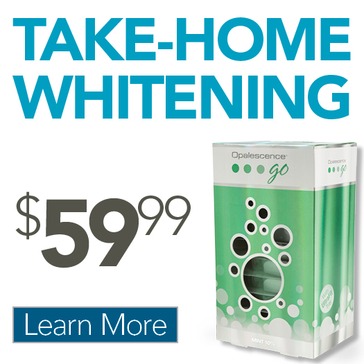 $49 Take-Home Whitening Kit Offer
