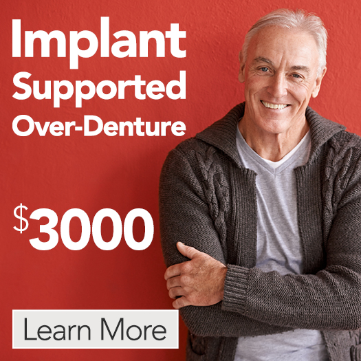 $3000 Implant Supported Over-Denture