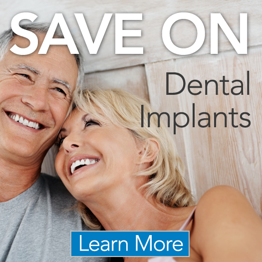 Dental Implants Offer