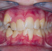 sheldon-collier-teeth-before