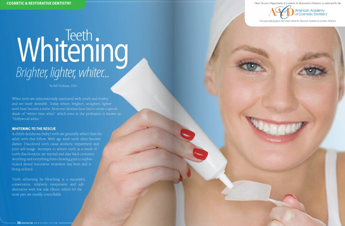 Teeth Whitening
