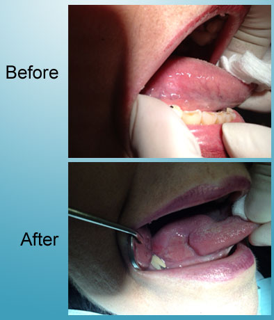 Lydia Valdez - Before & After