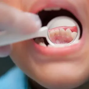 Blog-Can-Kids-Get-Periodontal-Disease