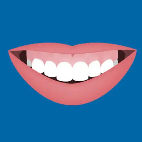 Blog-gummysmile
