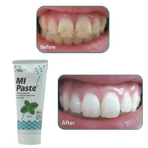 Blog-mipaste