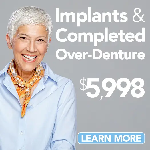 Implants & Completed Over-Denture