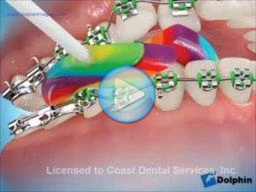 Broken Brackets