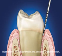 No sign of gum disease