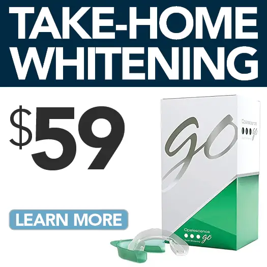 Take-Home Whitening