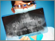 preventative-dentistry_xrays_03
