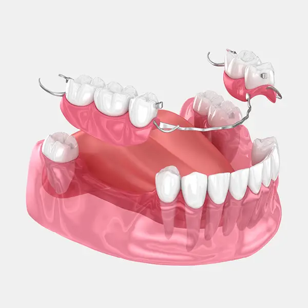 Replacement Dentures & Partial Dentures 3 services dentures removable partial 1