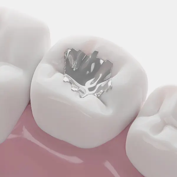 services-fillings